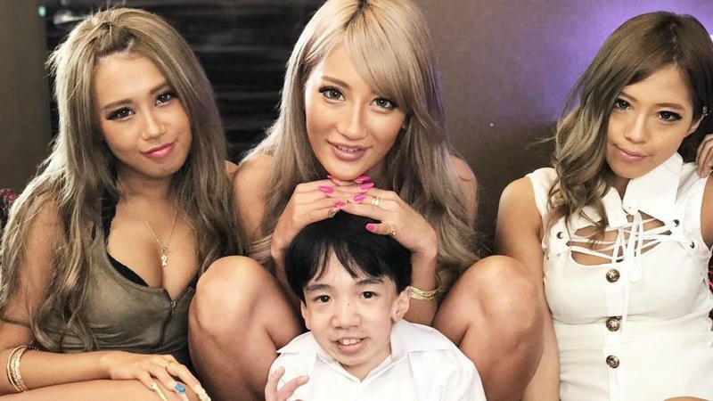 Từ Khiếm Khuyết Đến Lợi Thế Độc Đáo Trên Màn Ảnh